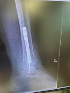 IMG-e2ff121997d7bc31c4bd8eb2e0c2f9ad-V